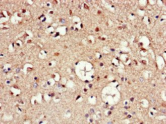 AAK1 Antibody