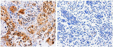 AAK1 antibody