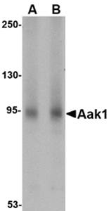 Aak1 Antibody