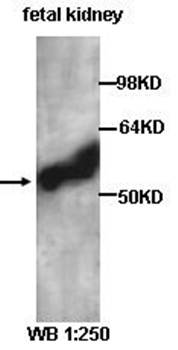 AAMP Rabbit Polyclonal Antibody