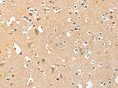 AANAT Antibody
