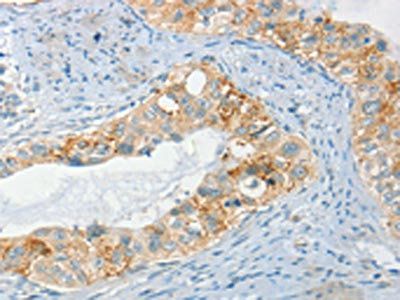 AANAT Antibody