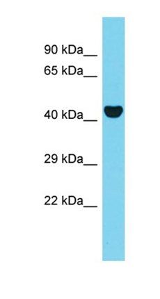 AAR2 antibody