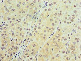 AARS2 antibody