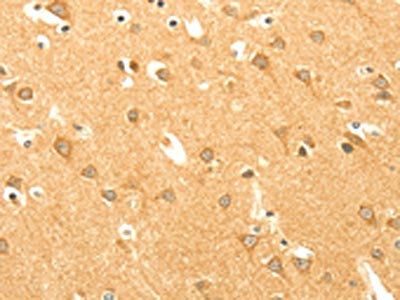 AARS2 Antibody