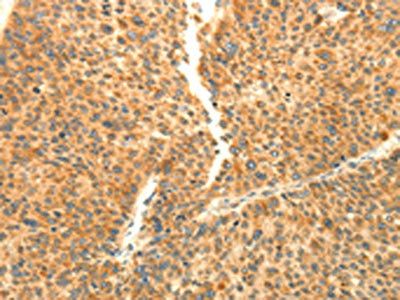 AARS2 Antibody