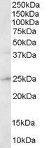 Goat anti-ABAD / HADH2 Antibody