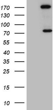 ABAT antibody