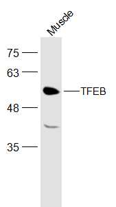TFEB antibody