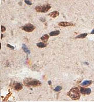 ABCA10 Rabbit Polyclonal Antibody