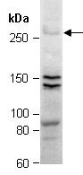 ABCA1 (C) Antibody, Rabbit Polyclonal