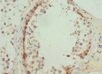 ABCA3 Antibody