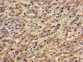 ABCA5 Antibody