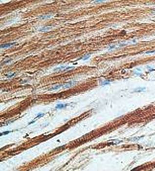 ABCA5 Rabbit Polyclonal Antibody