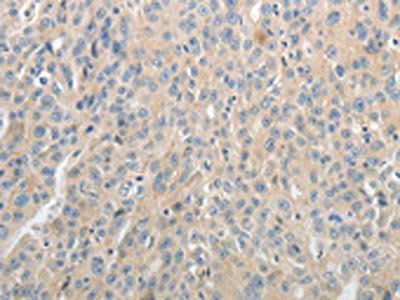 ABCB11 Antibody