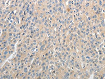 ABCB11 antibody