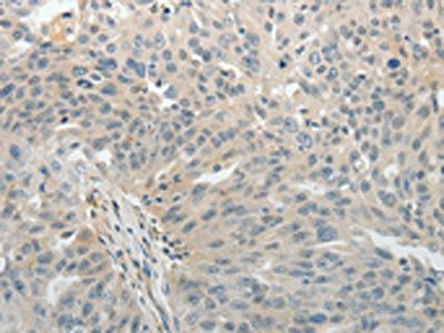 ABCB11 Antibody
