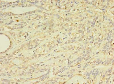 ABCB5 Antibody