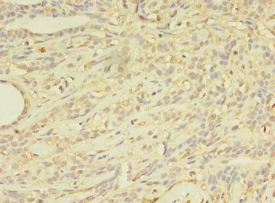 ABCB5 antibody