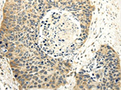 ABCB7 Antibody