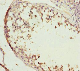 ABCB8 Antibody