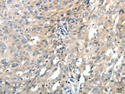 ABCC10 Antibody