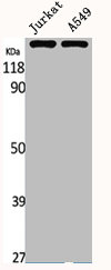ABCC10 Antibody