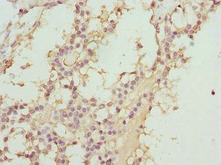 ABCC11 antibody