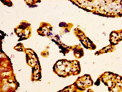 ABCC5 Antibody