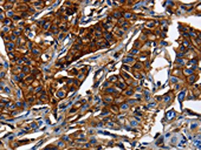 ABCC5 Antibody