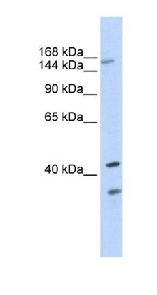 ABCC8 antibody