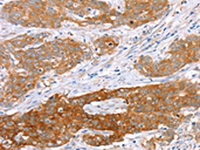 ABCC8 Antibody