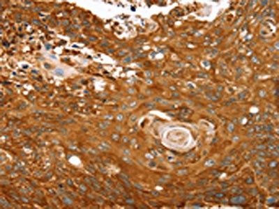 ABCC8 Antibody
