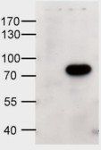 ABCD1 antibody