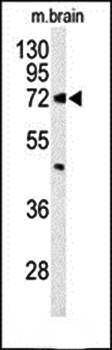 ABCD2 antibody