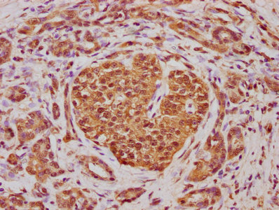 ABCD4 Antibody