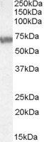 Goat anti-ABCD4 Antibody