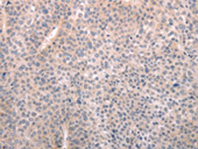 ABCF1 Antibody