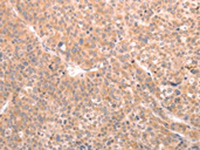 ABCF1 Antibody