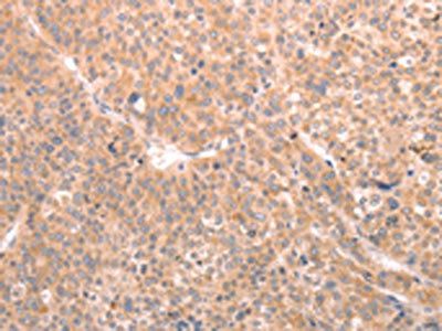 ABCF1 antibody