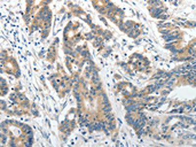 ABCG1 antibody