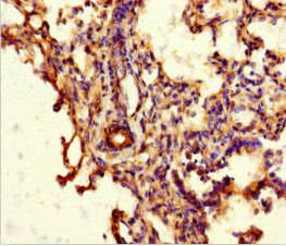 ABCG8 Antibody