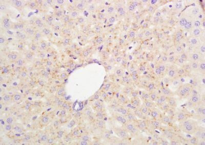 ABCG8 Rabbit Polyclonal Antibody
