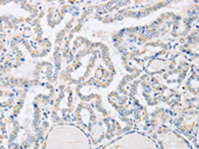 ABHD1 antibody