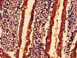 ABHD10 Antibody