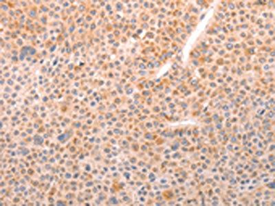 ABHD12 Antibody