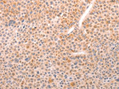 ABHD12 antibody