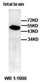 ABHD12B Rabbit Polyclonal Antibody