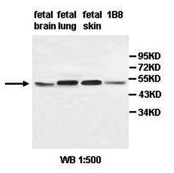 ABHD15 Rabbit Polyclonal Antibody