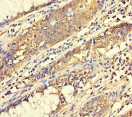 ABHD18 Antibody